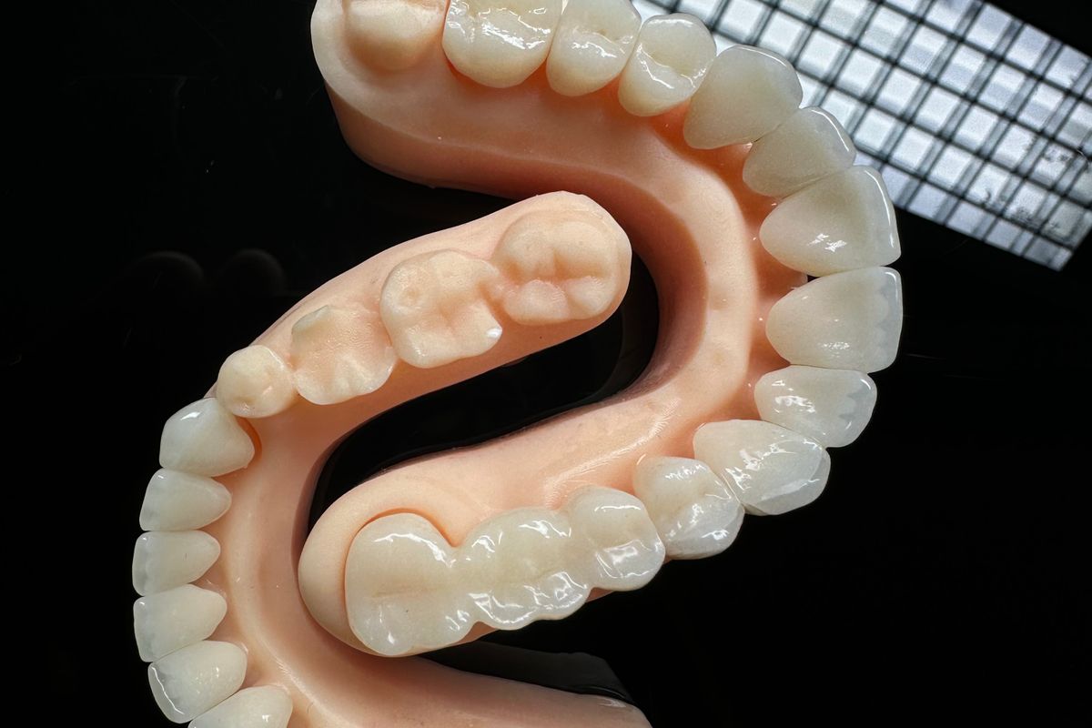 Zirconia bridge finished on a model at MARS USA Dental Lab